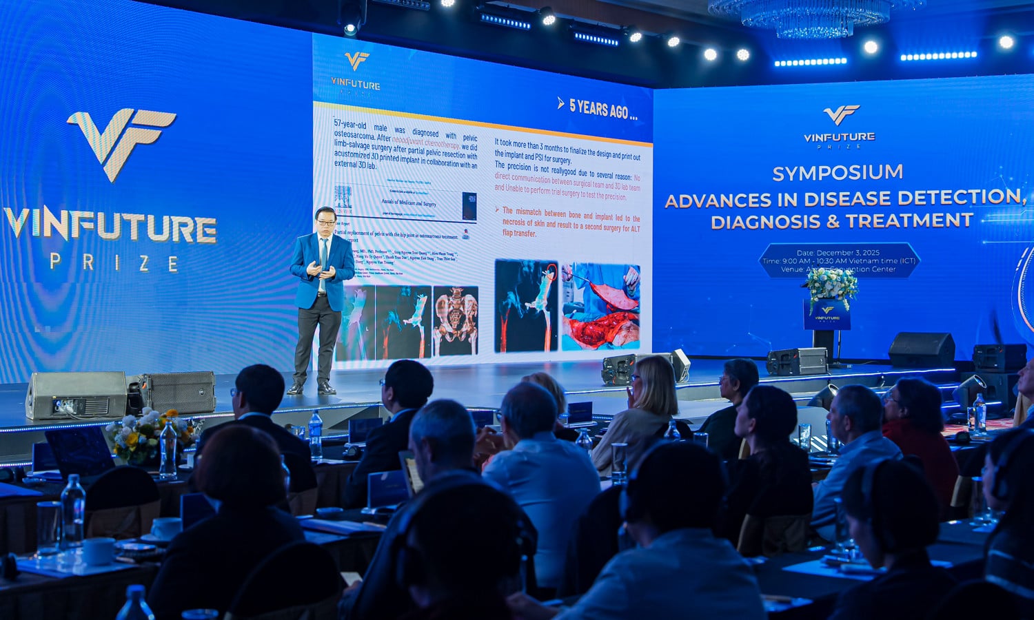 3D프린팅 골암 수술의 생존율 향상 효과